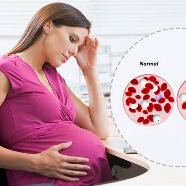 анемия при бременни