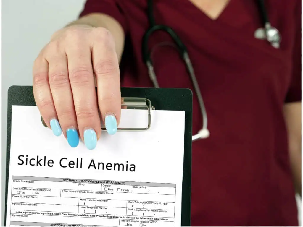 сърповидноклетъчна анемия