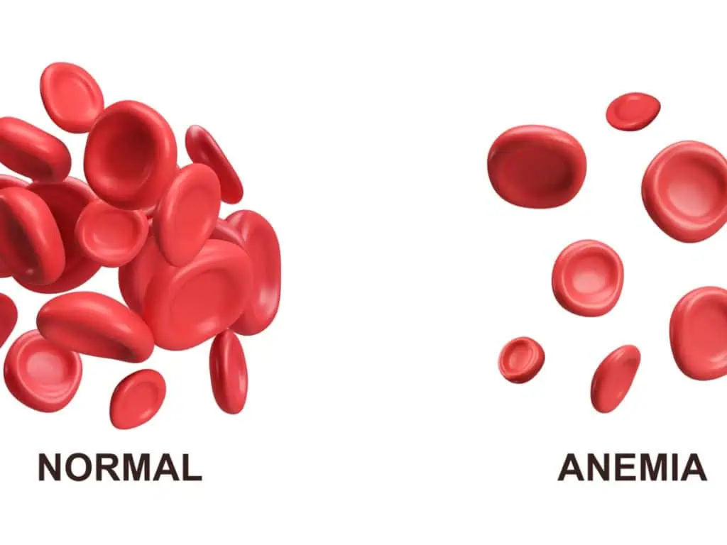 какво пречи на усвояването на желязо