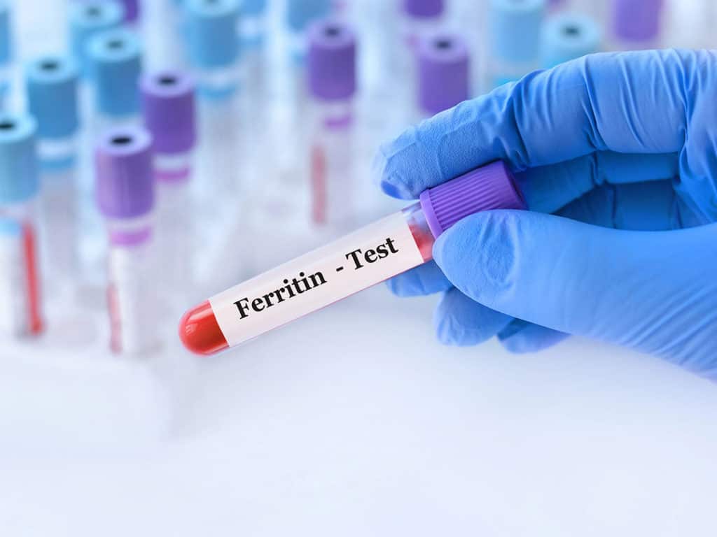 Ниският феритин означава ли анемия